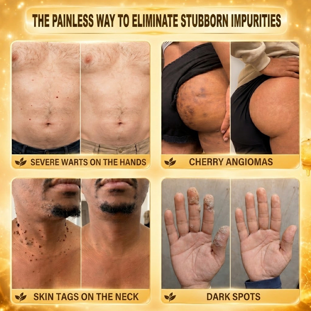 👩‍⚕️🎉 Official Flagship Store | CureVivo® 🐝 Microneedle Patch with Bee Venom (for warts, age spots, and blemishes)