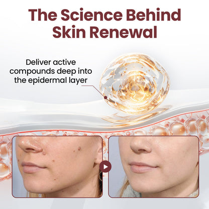 𝑶𝒇𝒇𝒊𝒄𝒊𝒂𝒍 𝑺𝒕𝒐𝒓𝒆 | 🏵️𝐑𝐨𝐩𝐜𝐞𝐞𝐫® KeraErase Dual-Action Renewal Cream 🇺🇸🕊️(Dual-Action Renewal – Softens raised bumps and breaks down deep keratin buildup without acids or irritation)
