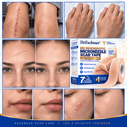 🥳 𝐎𝐟𝐟𝐢𝐜𝐢𝐚𝐥 𝐒𝐭𝐨𝐫𝐞丨Dr.Fachmer® 🩹 Bio-Regenerative Microneedle Scar Tape——Remove all kinds of skin scars