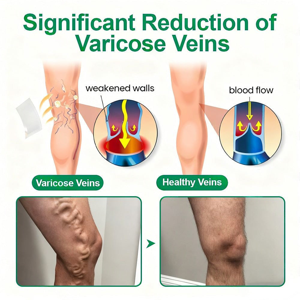 🇺🇸👨‍⚕️✅𝐇𝐞𝐚𝐥𝐫𝐢𝐳𝐞® VenoEase Soluble Microneedle Patch⚡Instant Relief, Long-Term Results ⚡