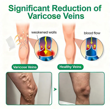 🇺🇸👨‍⚕️👍✅Healrize® VeinTarget Microneedle Patch⚡Instant Relief, Long-Term Results🗽